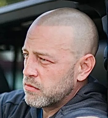 Micropigmentation Deposit