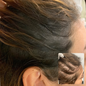 Woman Full Density Added Throughout Head